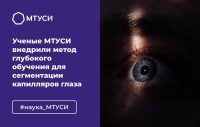 Ученые МТУСИ внедрили метод глубокого обучения для сегментации капилляров глаза